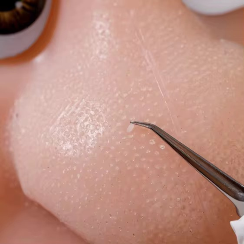 MrPimples™ - Handmade Piece