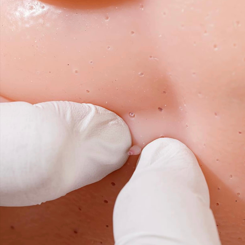 MrPimples™ - Handmade Piece